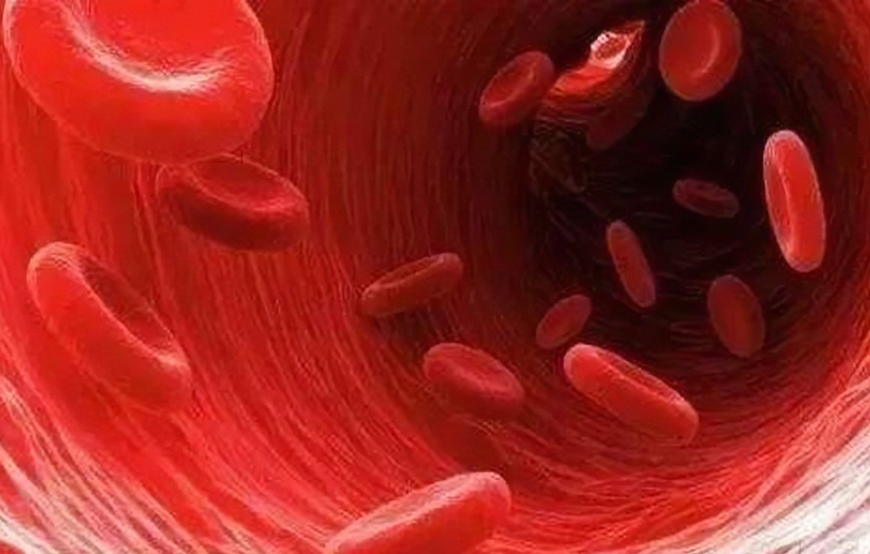 四川蓝生脑科医院提示：高血脂，“动脉硬化”的元凶！堵血管、伤内脏，后患无穷！